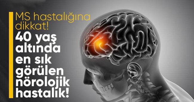 MS hastalığına dikkat! 40 yaş altında en sık oluşan nörolojik hastalık!