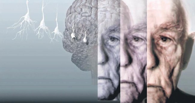 Korkulu rüyamız Alzheimer