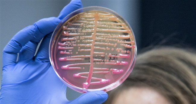 “Klebsiella pneumoniae” bakterisi antibiyotiklere karşı direnç kazanacak